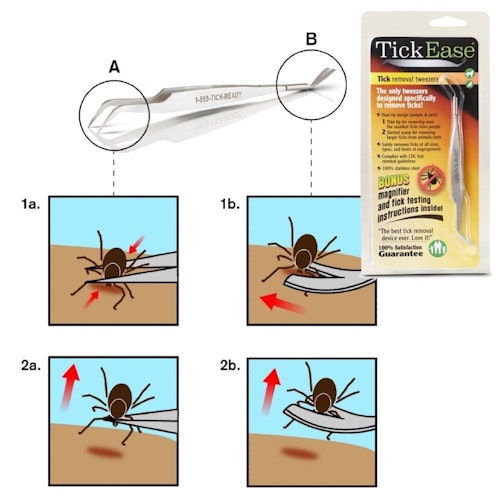 One end of TickEase is fine tipped (above, “A”) and designed for removing ticks from humans; the other end (“B”) works well on pets.