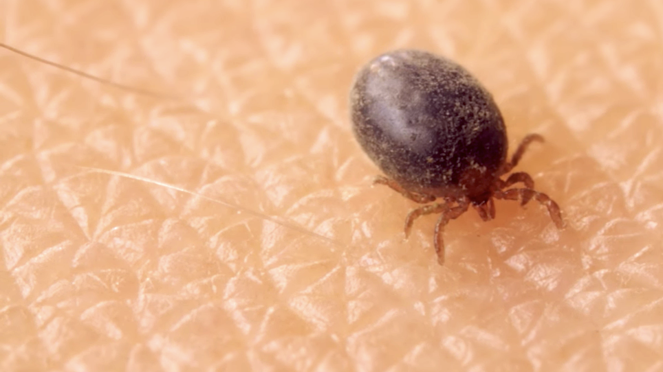 Here's How Ticks Embed in Your Skin, Suck Your Blood
