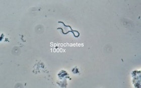 Bug of the Month: What Spirochaetes Indicate About Your Treatment Facility