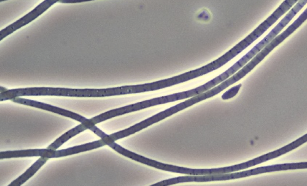 Bug of the Month: Sludge Bulking and Filament Type 021N