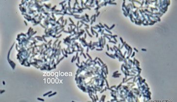 Bug of the Month: Zoogloea, the Glue of Floc Formation