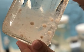 Microplastics Million Times More Abundant in Ocean Than Previously Thought